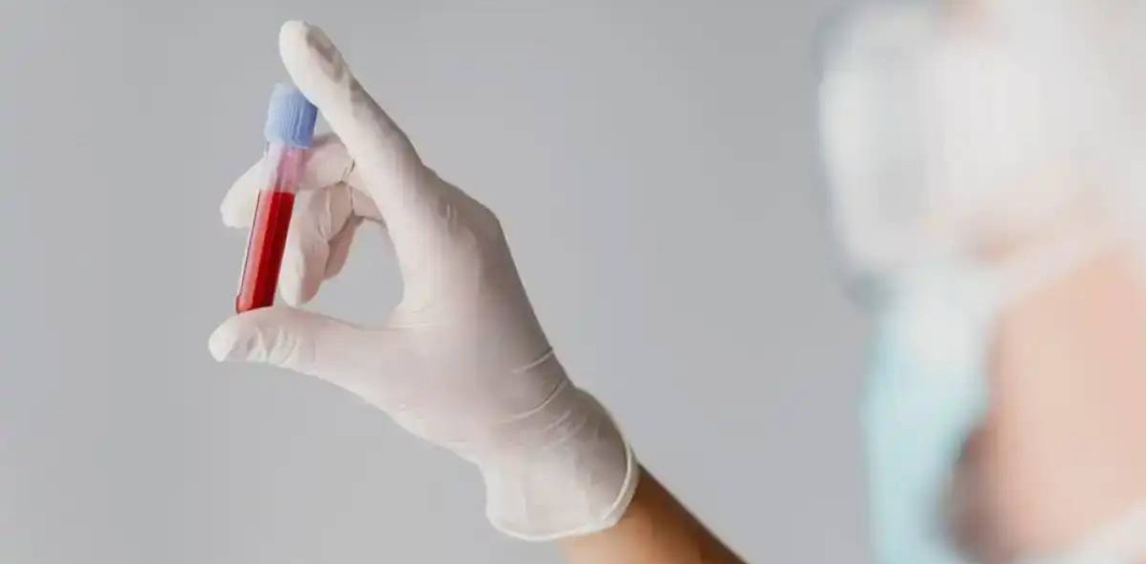 АИТВ және қызылша: қос қауіптен өзіңізді қалай қорғауға болады