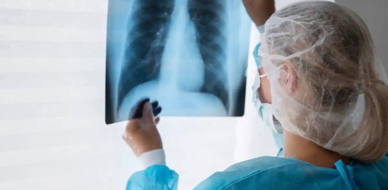 АИТВ жұқтырған адамдарда туберкулездің даму қаупі ерекше – астаналық дәрігер