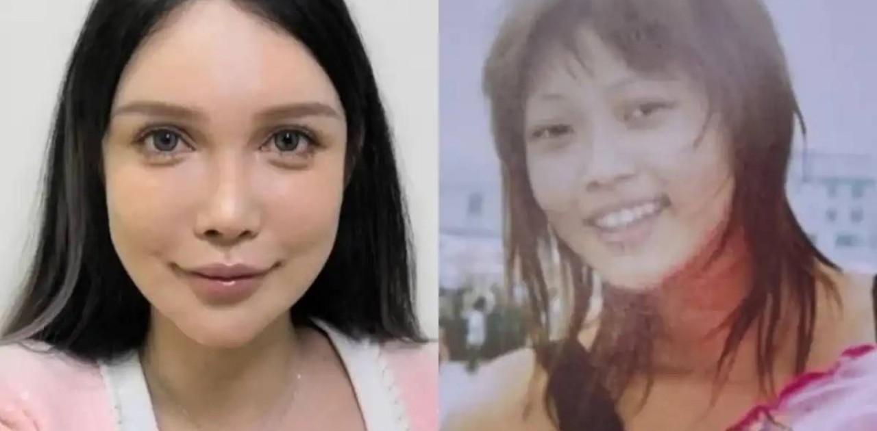 «100 рет пышаққа түстім. Тоқтайтын ойым да жоқ»: Қытайлық әйел сұлу болу үшін 10 жыл бойы операция жасатқан