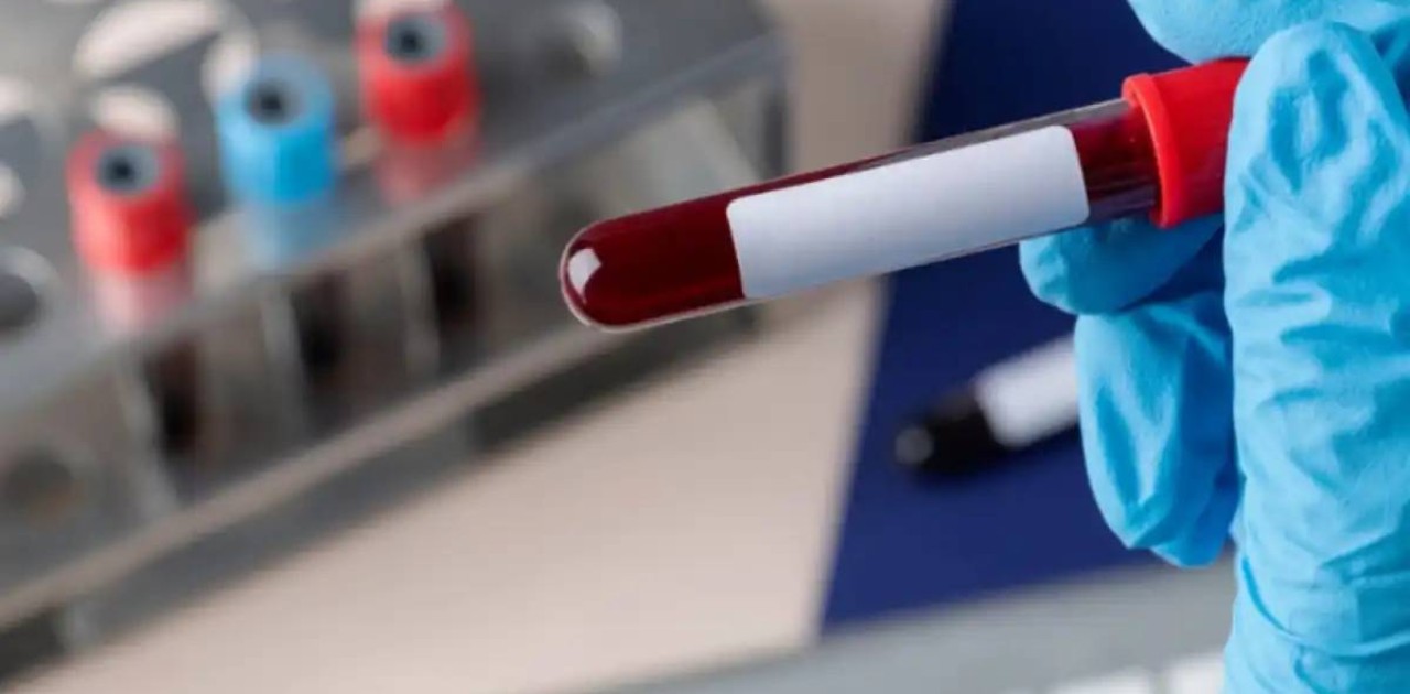 АИТВ кезіндегі стигма мен кемсітушілікке жол жоқ