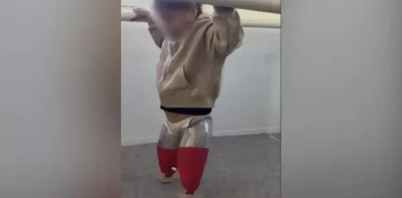 Автобус апатынан екі аяғынан айырылған бүлдіршін протезбен алғашқы қадамын жасады