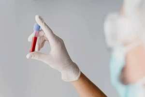 АИТВ және қызылша: қос қауіптен өзіңізді қалай қорғауға болады