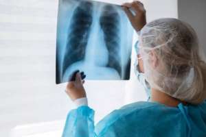 АИТВ жұқтырған адамдарда туберкулездің даму қаупі ерекше – астаналық дәрігер