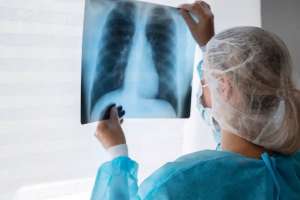 Елімізде туберкулезбен сырқаттанушылық 13,9 пайызға төмендеді