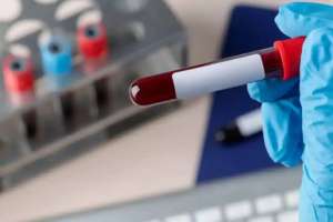 АИТВ кезіндегі оппортунистік инфекциялардың алдын алу