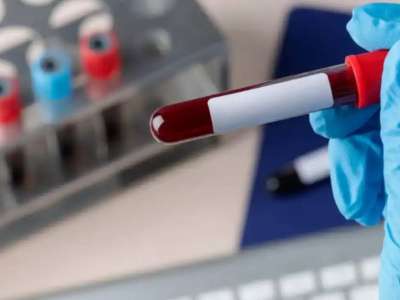 АИТВ кезіндегі оппортунистік инфекциялардың алдын алу