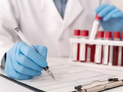 АИТВ инфекциясын жұқтыру қаупі бар топтар