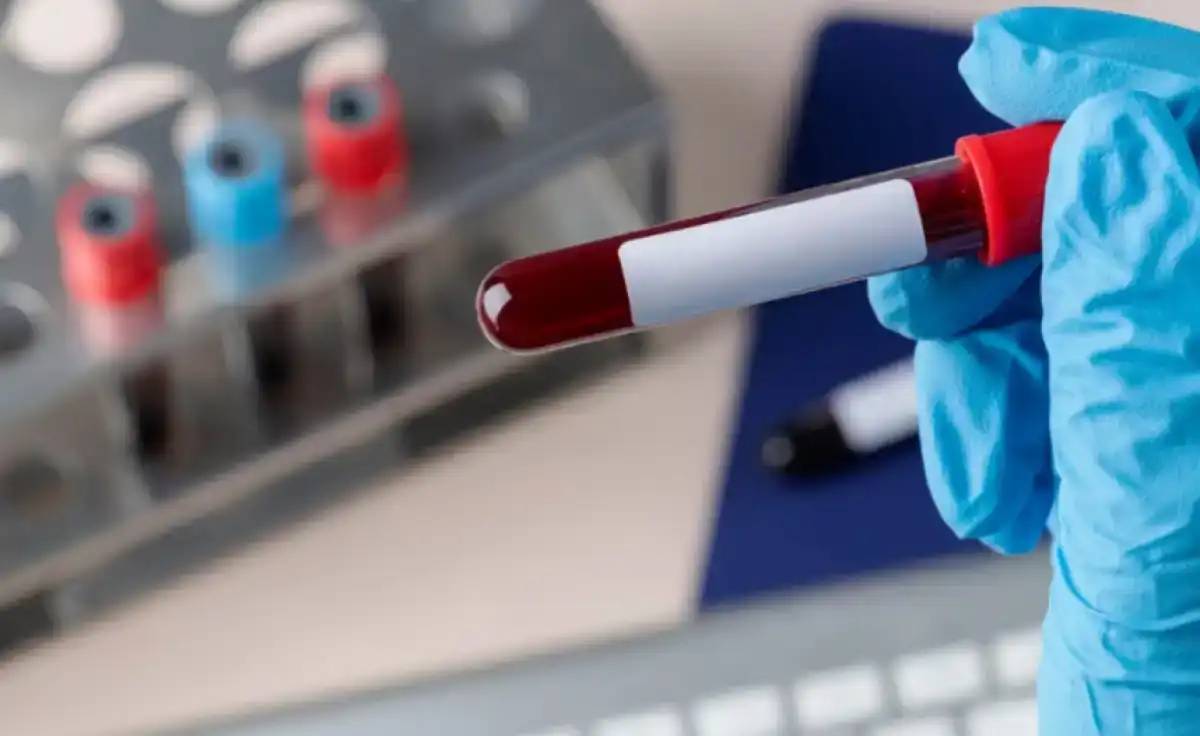 АИТВ кезіндегі оппортунистік инфекциялардың алдын алу