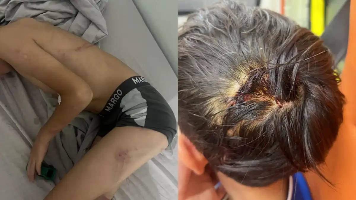 Балқашта соққыға жығылған 8 жасар баланың ісі бойынша тың деректер жарияланды